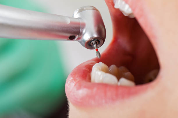 Best Emergency Dentist for Special Needs Patients in Nsfield Center, MA